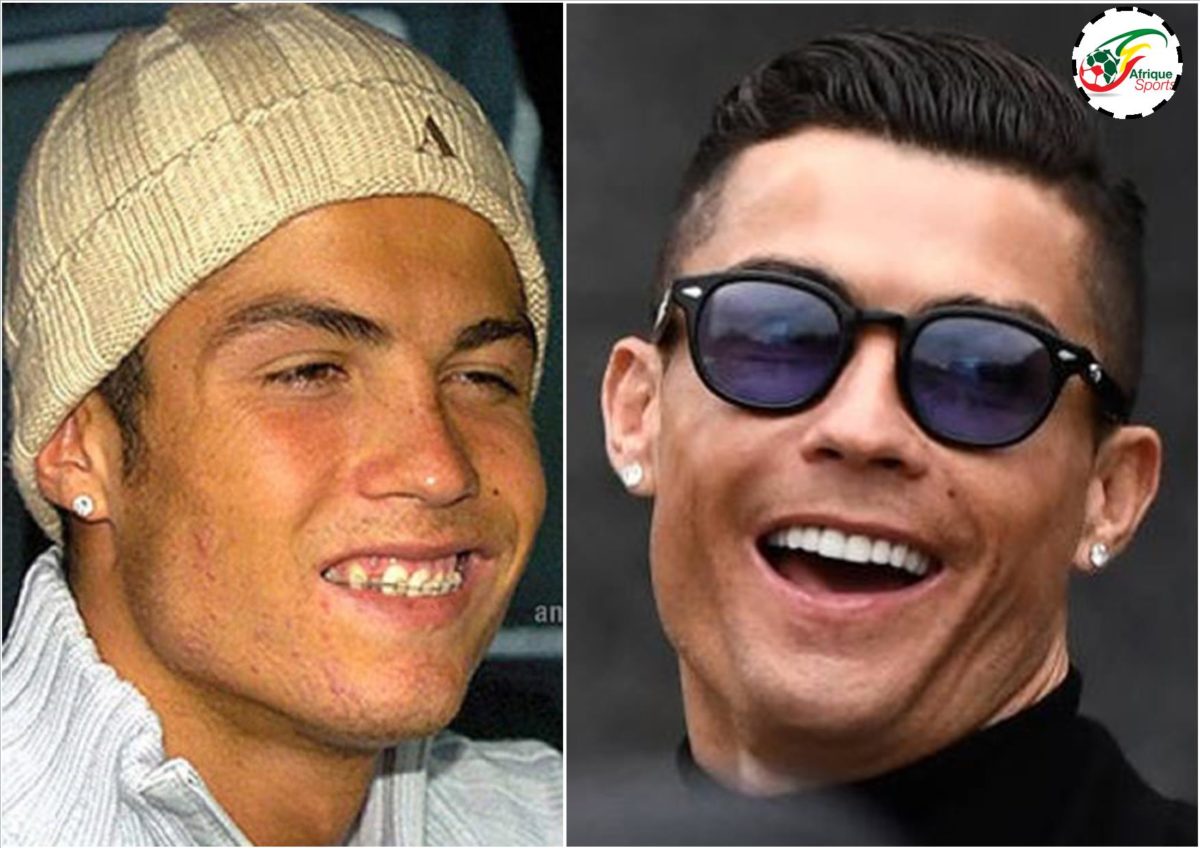 Ce qu’a fait Cristiano Ronaldo pour devenir attrayant et plus beau