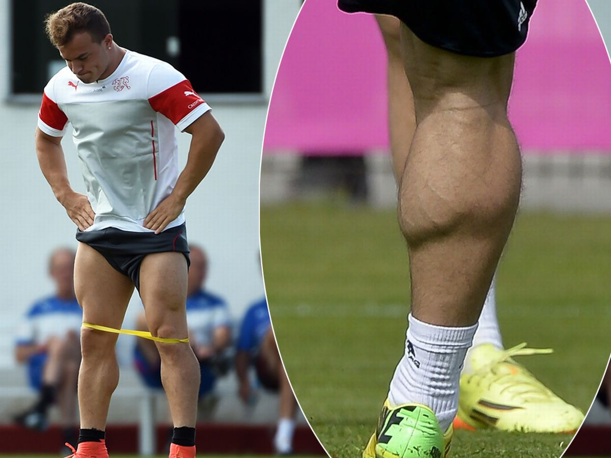 Xherdan Shaqiri leg MAIN