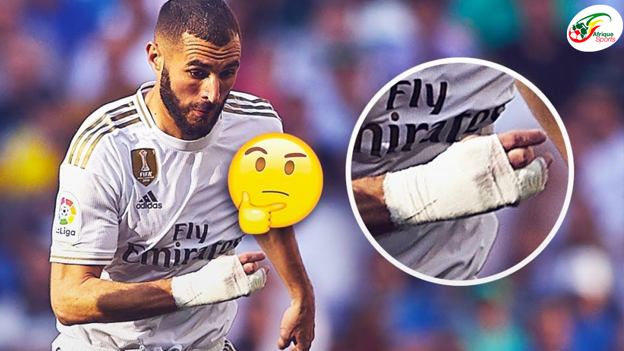 Pourquoi Benzema Joue Avec Un Bandage Terrible histoire, voici pourquoi Benzema joue avec un bandage à la main