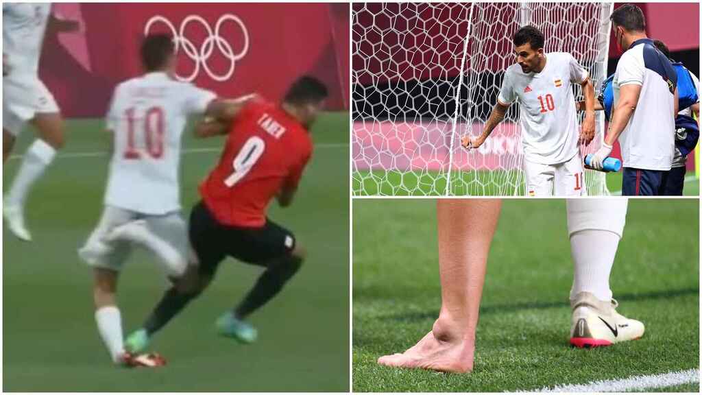 JO : L’effrayante blessure de Dani Ceballos avec l’Espagne (photos)