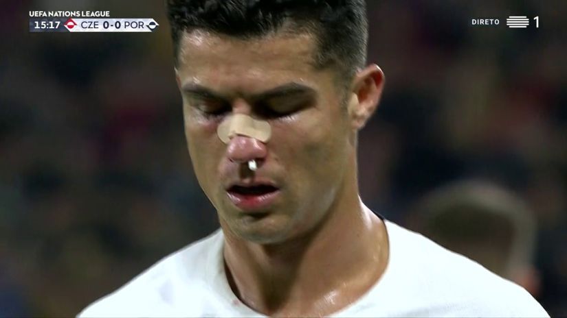 Cristiano Ronaldo Nez