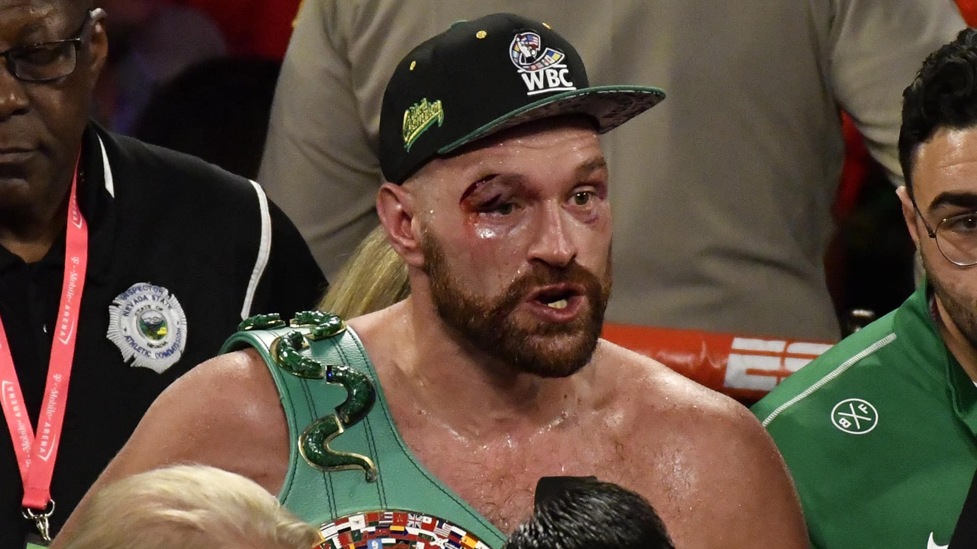 Incroyable, l’UFC propose son champion incontesté à Tyson Fury !