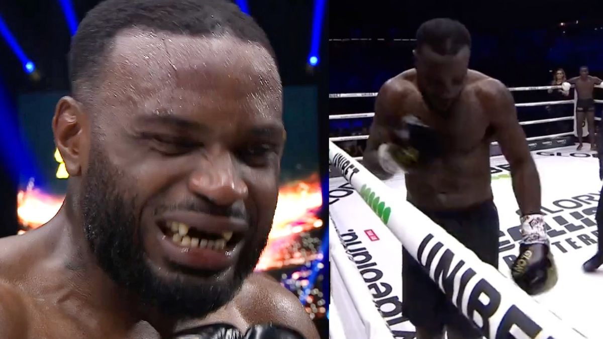 Weekend douloureux, Ulric Bokeme (congolais) perd 4 dents dans un combat en Kickboxing