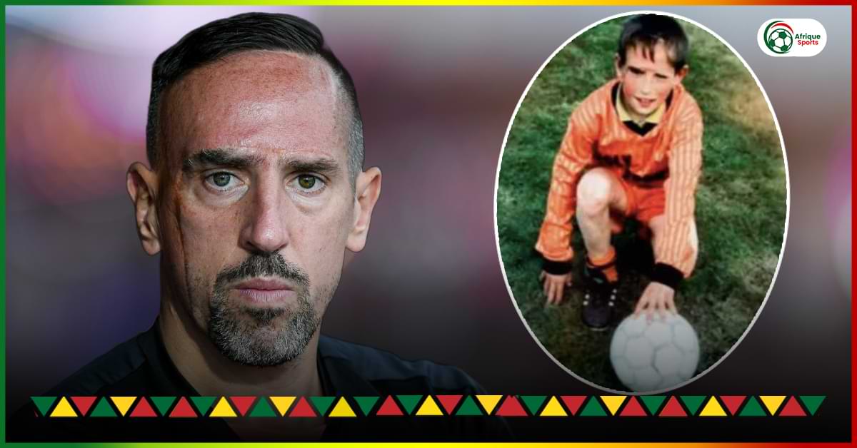 L’histoire déchirante des cicatrices faciales de Franck Ribéry