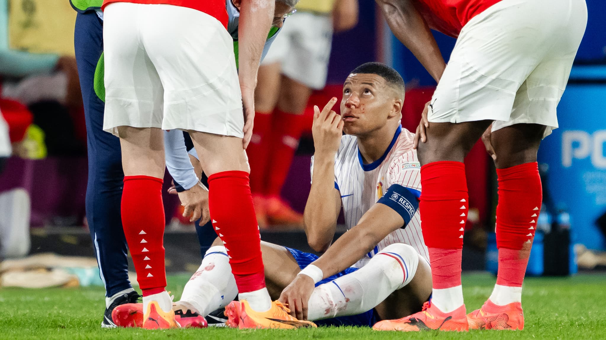 Kylian Mbappe touche au nez contre l Autriche lors de l Euro 2024 1885876