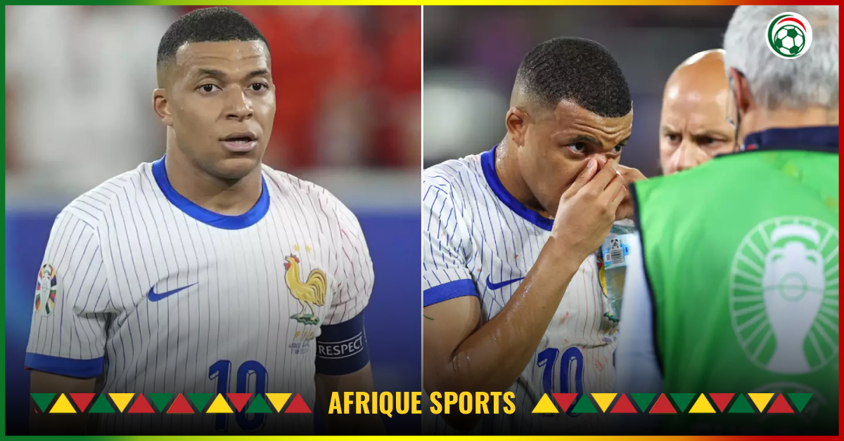 Euro 2024 : Le Message énigmatique de Mbappé au milieu des craintes