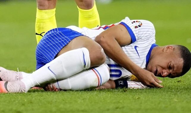 Euro 2024 : La folle réaction de Kylian Mbappé après sa terrible blessure