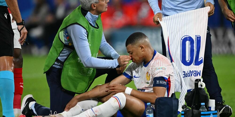 Euro terminé pour Kylian Mbappé ? L’annonce terrifiante de l’ex-médecin des bleus 2 Euro terminé pour Kylian Mbappé ? L’annonce terrifiante de l’ex-médecin des bleus