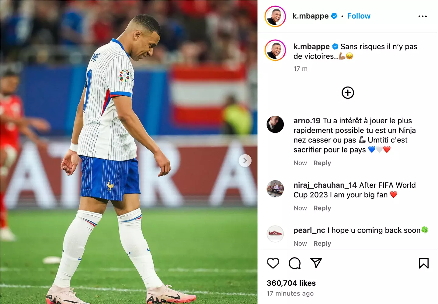 Euro 2024 : Le Message énigmatique de Mbappé au milieu des craintes