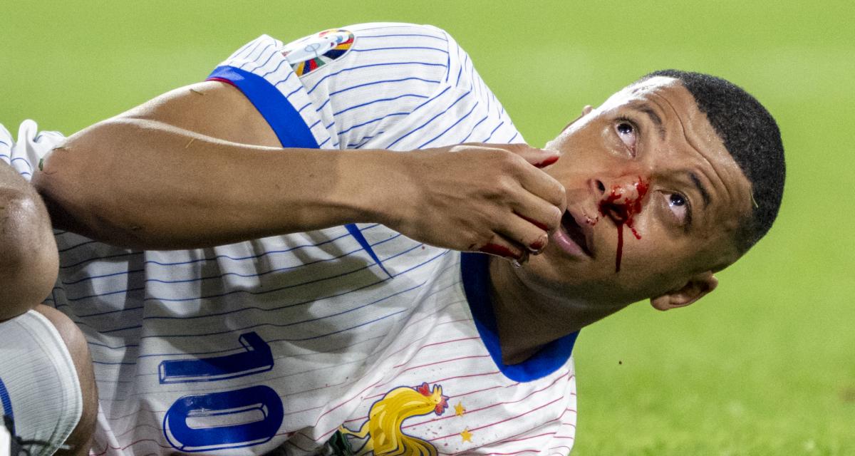 1200 L quipe de france quand mbapp ironise sur sa blessure au nez