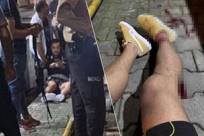 un ancien international turc victime d’un tir par balle 1 un ancien international turc victime d’un tir par balle